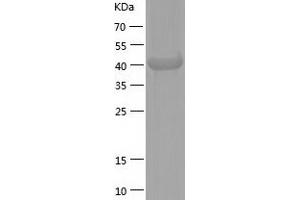 Western Blotting (WB) image for Phosphate Cytidylyltransferase 2, Ethanolamine (PCYT2) (AA 1-389) protein (His tag) (ABIN7288469) (PCYT2 Protein (AA 1-389) (His tag))