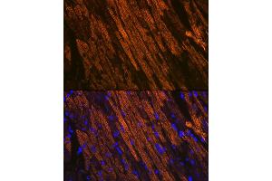 Immunofluorescence analysis of mouse heart using Cardiac Cardiac troponin T (TNNT2) (TNNT2) Rabbit mAb (ABIN7266088) at dilution of 1:100 (40x lens). (Cardiac Troponin T2 antibody)