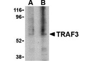 Western Blotting (WB) image for anti-TNF Receptor-Associated Factor 3 (TRAF3) (C-Term) antibody (ABIN1030765) (TRAF3 antibody  (C-Term))