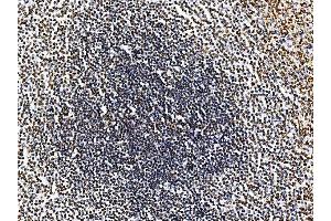 IHC analysis of RRS1 using anti-RRS1 antibody (ABIN7601344). (RRS1 antibody  (AA 33-266))