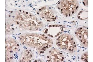 Image no. 4 for anti-UDP-Galactose-4-Epimerase (GALE) antibody (ABIN1498366)