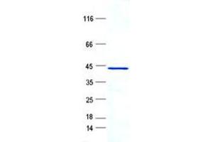 RPL28 Protein (GST tag,His tag)