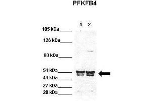WB Suggested Anti-PFKFB4 Antibody  Positive Control: Lane 1:441 µg HEK293 lysate Lane 2: 041 µg H1299 lysate Primary Antibody Dilution: 1:0000Secondary Antibody: Goat anti-rabbit-HRP Secondry  Antibody Dilution: 1:0000Submitted by: Jose Luis Rosa, Universitat de Barcelona (PFKFB4 antibody  (N-Term))