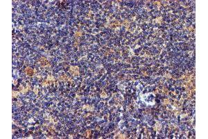 Image no. 7 for anti-NADH Dehydrogenase (Ubiquinone) Complex I, Assembly Factor 7 (NDUFAF7) antibody (ABIN1499667) (NDUFAF7 antibody)