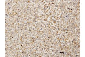 Immunoperoxidase of monoclonal antibody to SDF2 on formalin-fixed paraffin-embedded human liver. (SDF2 antibody  (AA 20-211))