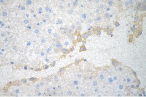 Immunohistochemistry was performed on paraffin-embedded mouse liver using acyl-CoA dehydrogenase short chain antibody (ABIN7797493), 1:200).
