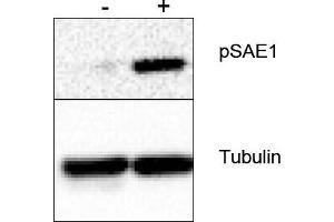 Image no. 1 for anti-SUMO1 Activating Enzyme Subunit 1 (SAE1) (Ser185) antibody (ABIN401468) (SAE1 antibody  (Ser185))