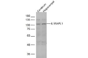 Lane 1: mouse cerebrum Lane 2: mouse hippocampal lysates probed with IL1RAPL1 Polyclonal Antibody, Unconjugated  at 1:1000 dilution and 4˚C overnight incubation.