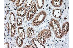 Immunohistochemical staining of paraffin-embedded Human Kidney tissue using anti-NUDT9 mouse monoclonal antibody.
