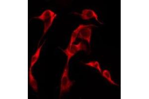 ABIN6276251 staining Hela by IF/ICC. (OR51F1 antibody)