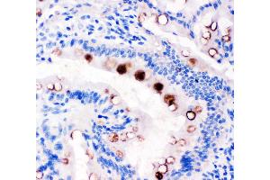 Anti-Estrogen Inducible Protein pS2 antibody, IHC(P) IHC(P): Rat Intestine Tissue (TFF1 antibody  (Middle Region))