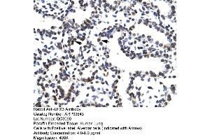 Human Lung (LHX3 antibody  (Middle Region))