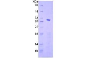SDS-PAGE analysis of Human Smad4 Protein. (SMAD4 Protein)