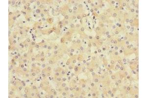 Immunohistochemistry of paraffin-embedded human liver tissue using ABIN7159906 at dilution of 1:100 (TIMM5 (AA 87-353) antibody)