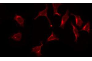 ABIN6269075 staining SK-OV3 by IF/ICC. (EGFR antibody  (C-Term))
