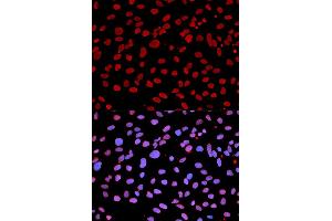 Immunofluorescence analysis of U2OS cells using IFIH1 antibody (ABIN5971229). (IFIH1 antibody)