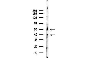 Western blot analysis of lysates from 293 cells(heat-shock,45 min treatment), using BCL7A Antibody at 1/1000 dilution.