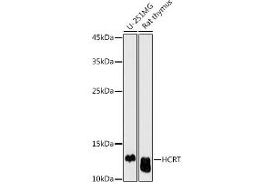 Western blot analysis of extracts of various cell lines, using HCRT antibody (ABIN6128406, ABIN6141654, ABIN6141655 and ABIN6225128) at 1:500 dilution. (Orexin antibody  (AA 34-131))