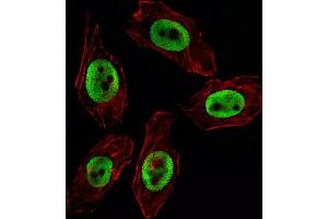 Immunofluorescence (IF) image for anti-Enhancer of Zeste Homolog 2 (EZH2) antibody (ABIN2995316) (EZH2 antibody)