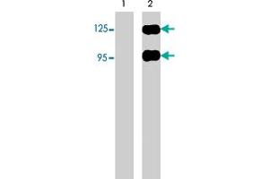 Western blots of neonatal rat brain (lane 1) and human recombinant SEMA3A chimera (95/125 kDa) (lane 2). (SEMA3A antibody  (N-Term))