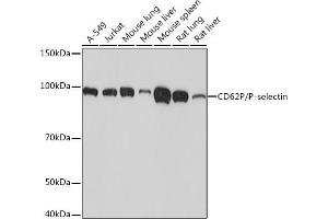 Western blot analysis of extracts of various cell lines, using CD62P/P-selectin Rabbit mAb (ABIN7270190) at 1:1000 dilution.