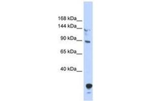 Image no. 1 for anti-Tubby Like Protein 4 (TULP4) (N-Term) antibody (ABIN6742856) (TULP4 antibody  (N-Term))