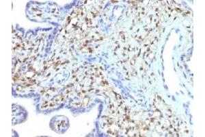 IHC testing of FFPE human placenta with FSP1 antibody (clone S100A4/1481).