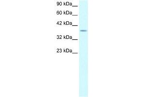 WB Suggested Anti-KLF8 Antibody Titration:  0. (KLF8 antibody  (Middle Region))