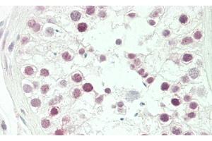 Formalin-fixed and paraffin-embedded H. (NCAPH antibody  (AA 354-382))