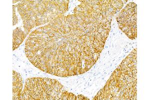 Immunohistochemistry (IHC) image for anti-Epithelial Cell Adhesion Molecule (EPCAM) (AA 24-265) antibody (ABIN7455170) (Recombinant EpCAM antibody  (AA 24-265))