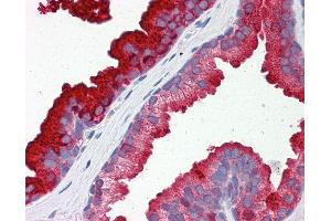 Anti-RAB23 antibody IHC of human prostate.