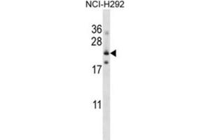 Western Blotting (WB) image for anti-Folate Receptor 3 (Gamma) (FOLR3) antibody (ABIN2997435) (FOLR3 antibody)