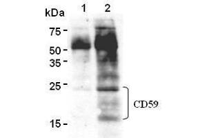 Western Blotting (WB) image for anti-CD59 (CD59) antibody (ABIN1449269) (CD59 antibody)