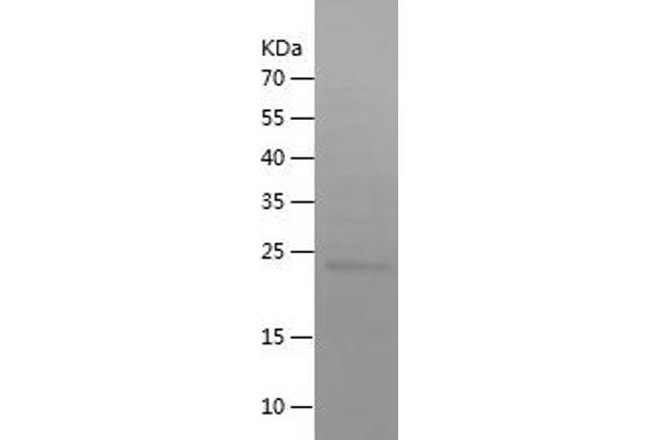 POR Protein (AA 43-226) (His tag)