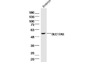 Mouse embryo lysates probed with SLC17A5 Polyclonal Antibody, Unconjugated  at 1:300 dilution and 4˚C overnight incubation. (Solute Carrier Family 17 (Acidic Sugar Transporter), Member 5 (SLC17A5) (AA 201-300) antibody)