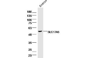 Image no. 1 for anti-Solute Carrier Family 17 (Acidic Sugar Transporter), Member 5 (SLC17A5) (AA 201-300) antibody (ABIN5675793)