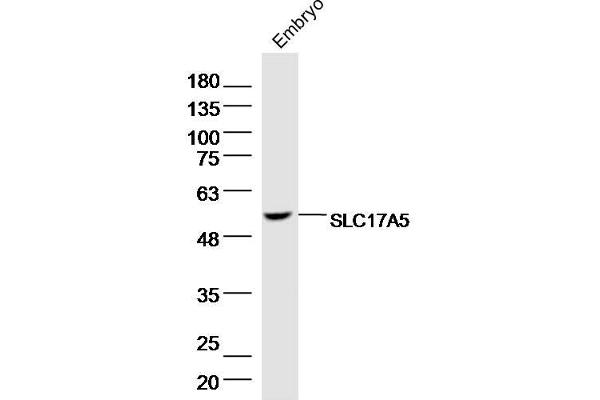 Solute Carrier Family 17 (Acidic Sugar Transporter), Member 5 (SLC17A5) (AA 201-300) anticorps