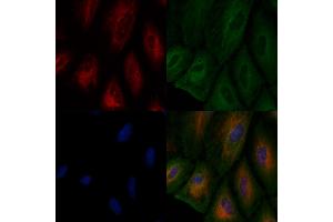 ABIN6257005 and ABIN6275940 staining  cells by IF/ICC.