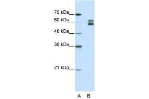 WB Suggested Anti-MSH2 Antibody Titration:  1. (MSH2 antibody  (N-Term))
