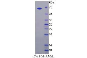 SDS-PAGE (SDS) image for Toll-Like Receptor 3 (TLR3) (AA 381-699) protein (His tag,GST tag) (ABIN6239152)
