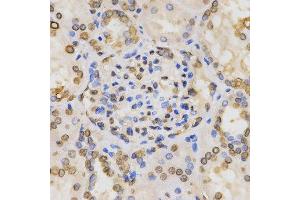 Immunohistochemistry of paraffin-embedded human kidney tissue using H3K36me2 antibody at dilution of 1:200 (x400 lens) (Histone 3 antibody  (H3K36me2))