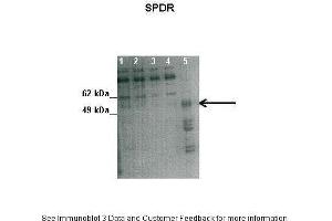 SDPR anticorps  (N-Term)