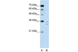 CD8B antibody used at 1 ug/ml to detect target protein. (CD8B antibody  (N-Term))