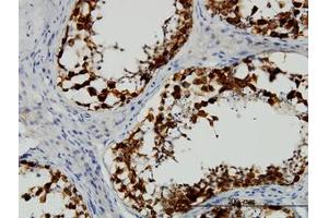 Image no. 1 for anti-Deleted in Azoospermia 1 (DAZ1) (AA 21-121) antibody (ABIN598639) (DAZ1 antibody  (AA 21-121))