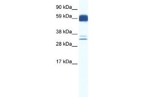 WB Suggested Anti-ZIC5 Antibody Titration:  0.