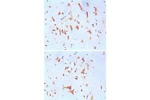 Immunohistochemical analysis of paraffin-embedded human brain tissues, showing cytoplasmic localization with DAB staining using FMR1 monoclonal antibody, clone 4G9  . (FMR1 antibody)