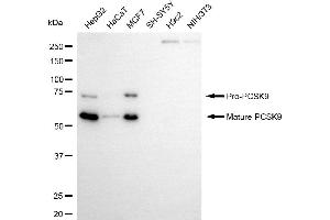 Western blotting analysis using PCSK9 antibody (ABIN7799926).