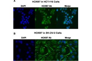Immunofluorescent staining of (A) HCT-116 and (B) SK-OV-3 cells with HOXB7 polyclonal antibody  under 4 ug/mL working concentration. (HOXB7 antibody  (AA 168-217))