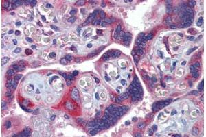 Human Placenta (formalin-fixed, paraffin-embedded) stained with GTPBP10 antibody ABIN462237 followed by biotinylated goat anti-rabbit IgG secondary antibody ABIN481713, alkaline phosphatase-streptavidin and chromogen. (GTPBP10 antibody  (AA 254-303))