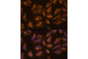 Immunofluorescence analysis of U-2 OS cells using LysRS/LysRS/KARS Rabbit pAb (ABIN6128149, ABIN6142683, ABIN6142684 and ABIN6217884) at dilution of 1:100 (40x lens). (KARS antibody  (AA 298-597))